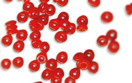 O型圈失效引起的車(chē)輛漏油問(wèn)題